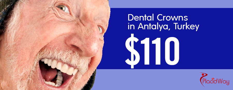 Dental-Crowns-Package in-Antalya,-Turkey_price